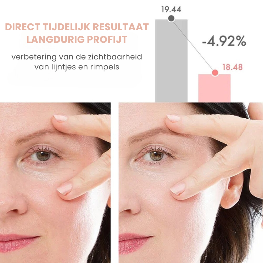 SILKY™ | Anti-Rimpel Gezicht Balsem