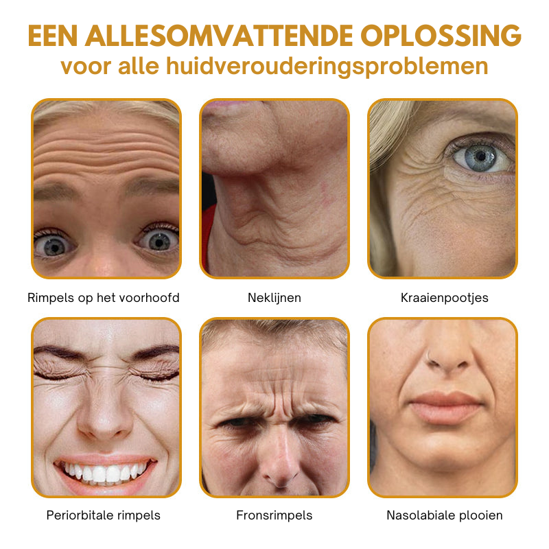 Anti-Wrinkle™ | Botox Rimpelverwijdering Crème