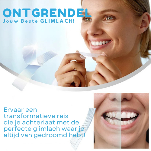 EaseSmile™ | Tanden Aligner Strips
