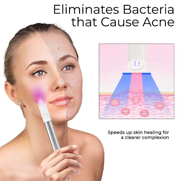 Light Therapy™ | Elektrische Acne Verdwijnpen