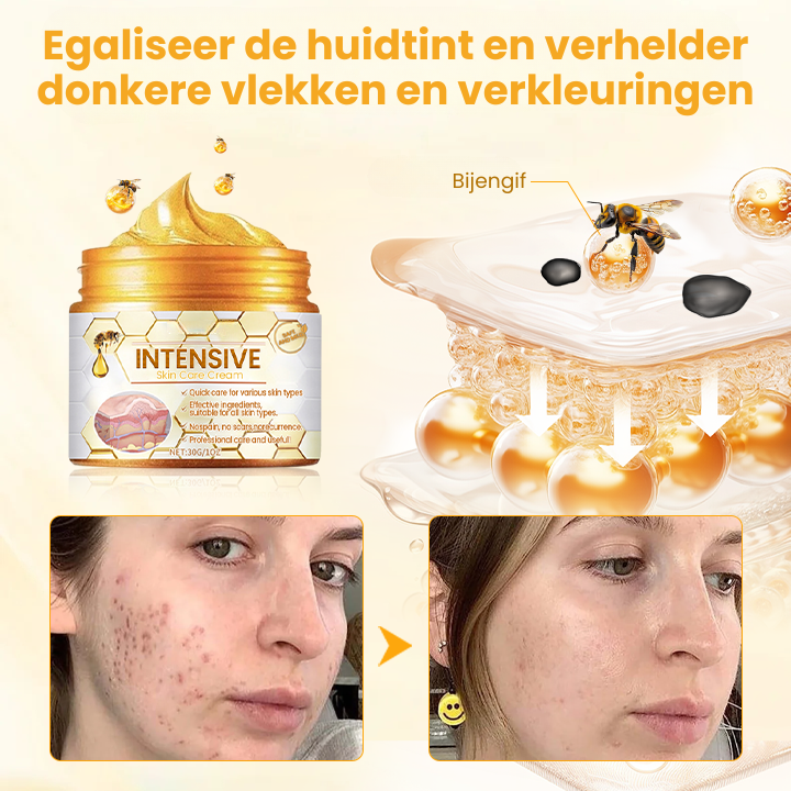 IntensiveRepair™ | Huidverzorgingscrème