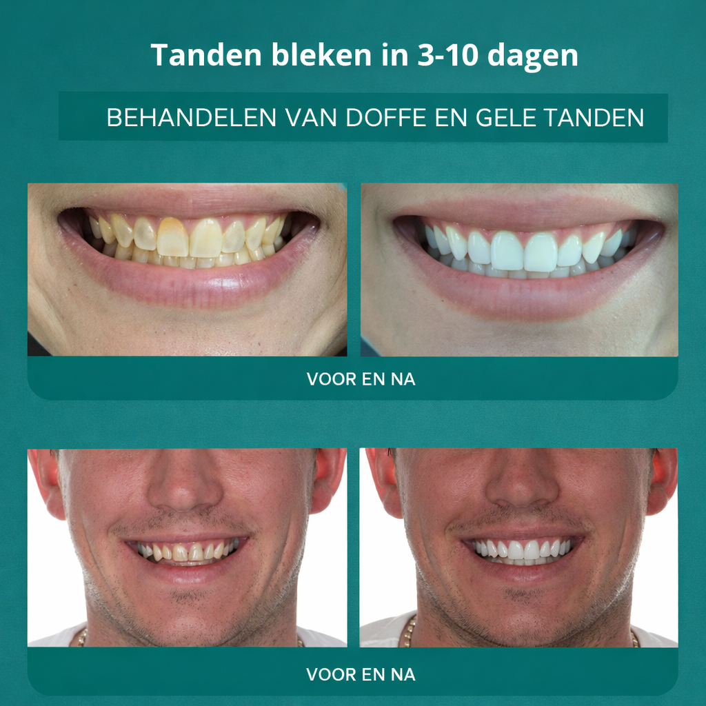1+1 GRATIS: DentaSmile™ | Tandverzorgend Mineraalpoeder