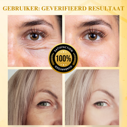 BotoxBee™ | Geavanceerde Multi-Actie Verstevigende Crème