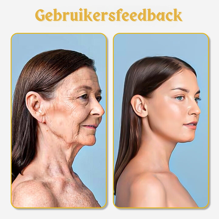 YouthGlow™ | UltraRenew Ultrasoon Facelift Apparaat