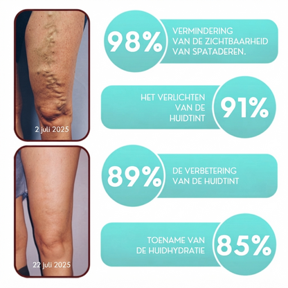 VascuMend™ | Spataderpleister