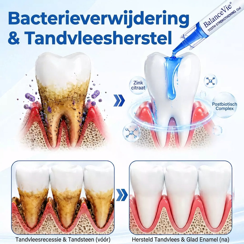 BalanceVie | Tandvlees Herstelgel - Steviger aanvoelend en rustiger tandvlees in 7 dagen