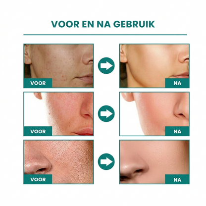 1+1 GRATIS: GlowSkin™ | Huid Egalisatie Serum