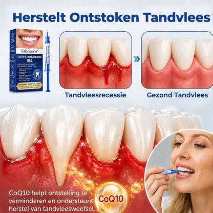 BalanceVie | Tandvlees Herstelgel - Steviger aanvoelend en rustiger tandvlees in 7 dagen