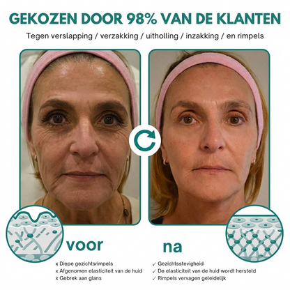 1+1 GRATIS: AntiAge™ | Rimpelcorrectie Crème