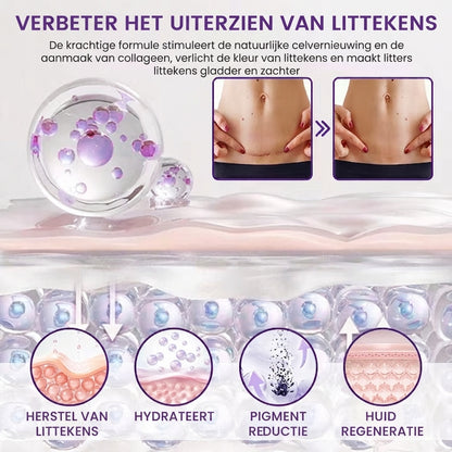 ScarLift™ | LittekenHerstel Gel