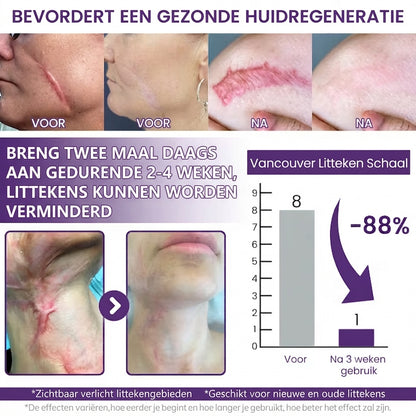 ScarLift™ | LittekenHerstel Gel