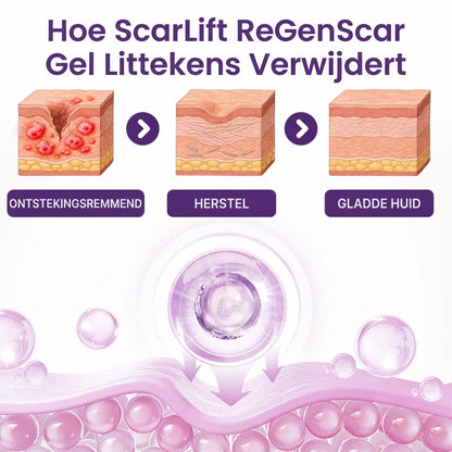 ScarLift™ | LittekenHerstel Gel
