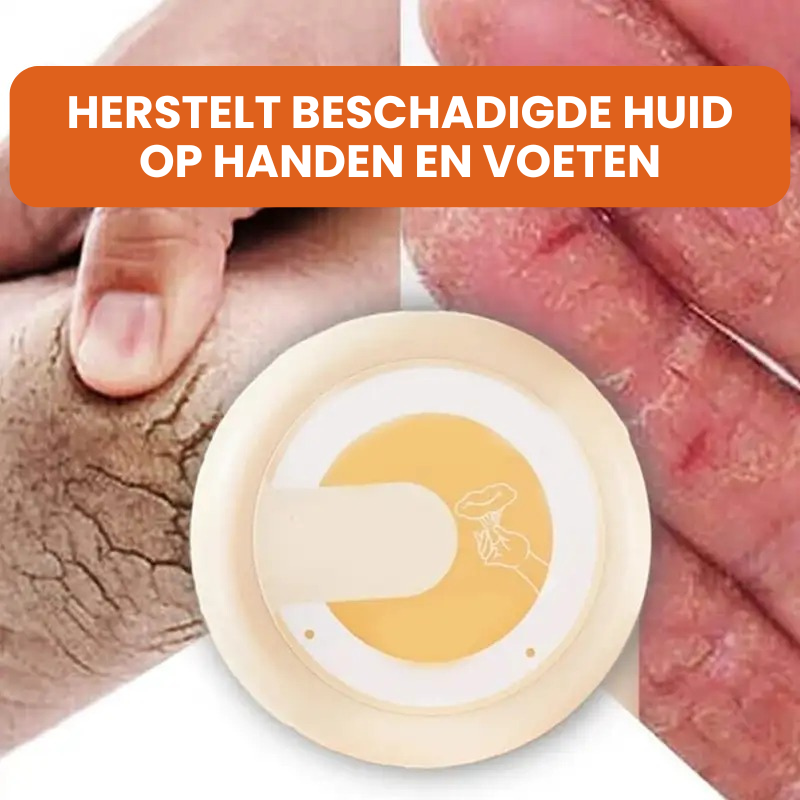 NOURISA™ | Droge en Schrale Huid Crème