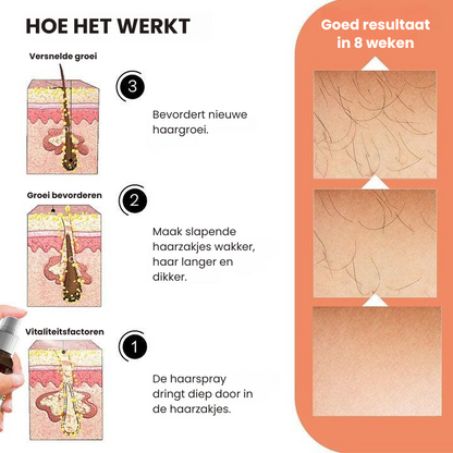 GrowHair™ | Haargroeispray