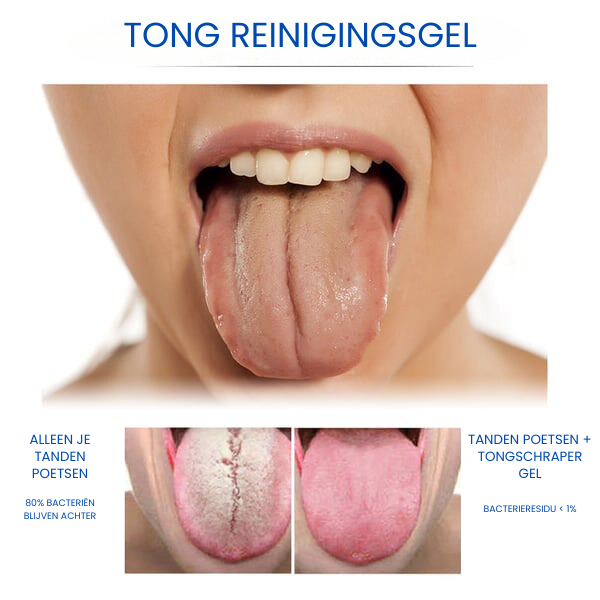 CLEANZYL™ | Tong Reinigingsgel Set