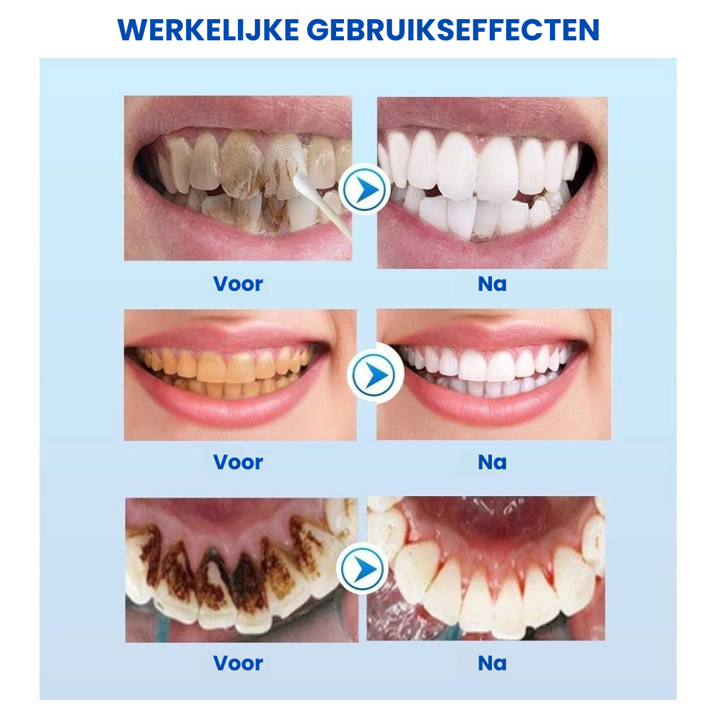 White Teeth™ | Tanden Bleek Essence