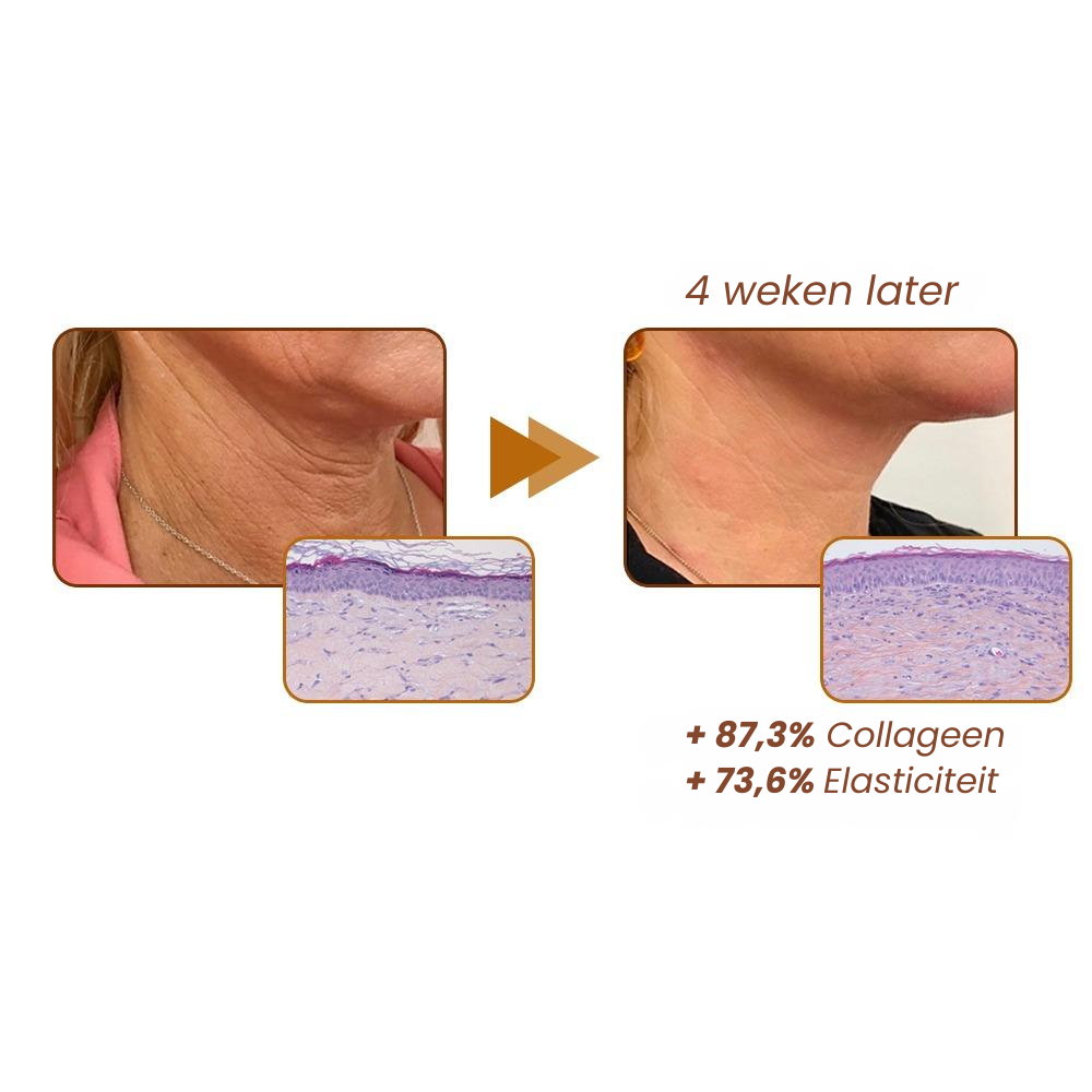 Reversal Peptide™ | Anti-rimpel Serum