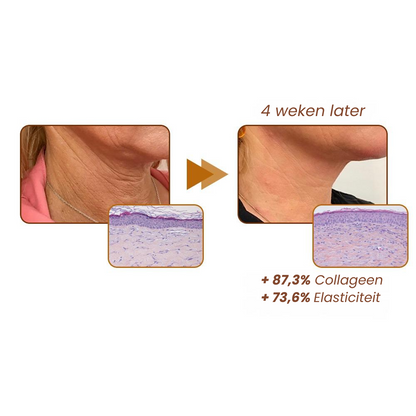 Reversal Peptide™ | Anti-rimpel Serum