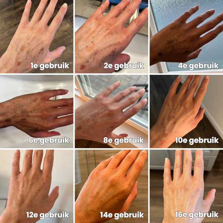 Reversal Peptide™ | Anti-rimpel Serum