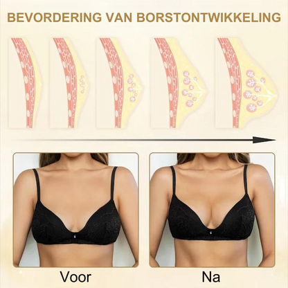 EnhanceLift™ | Borstenverstevigende Patches