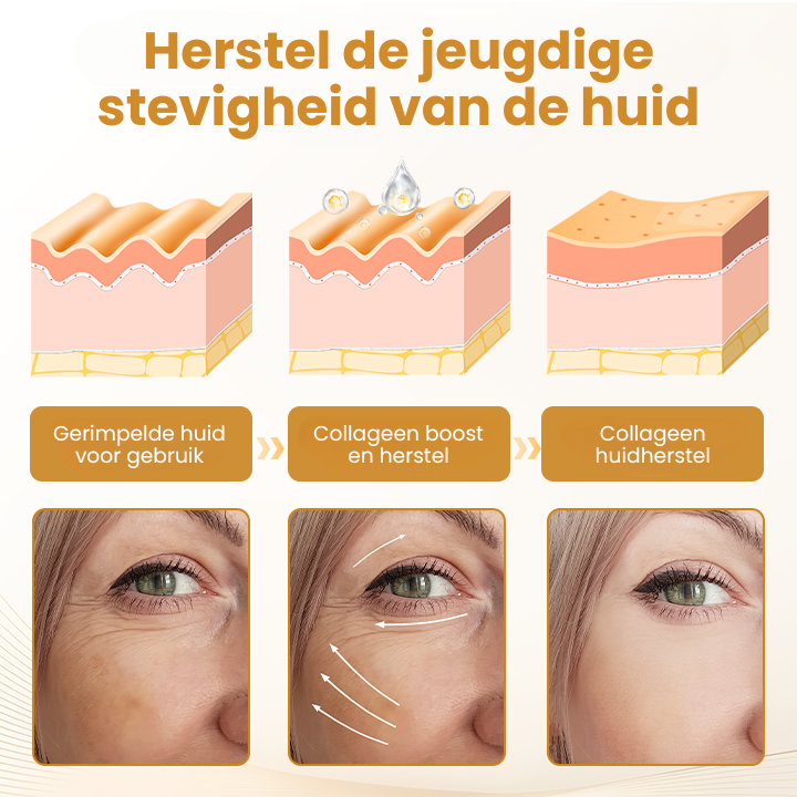 BotoxLux™ | Anti-rimpelserum