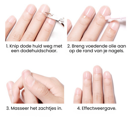 NAILE™ | Nagel Groei Olie Pen