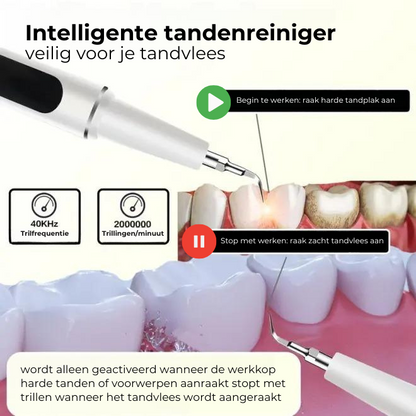 TARTYZE™ | Ultrasone Elektrische Tandenreiniger