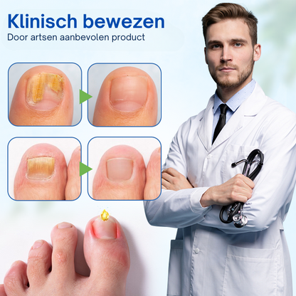 HealthyNail™ | Anti-Schimmel Nagelherstelzalf