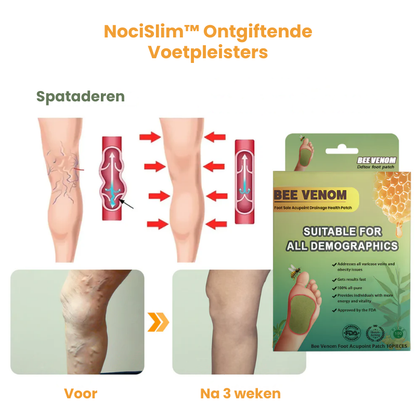 NociSlim™ | Ontgiftende Voetpleisters
