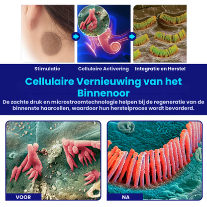 EchoEase™ | Tinnitus Oorpleister