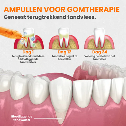 FIXEROOT™ | Tandvleesherstel Behandelampullen
