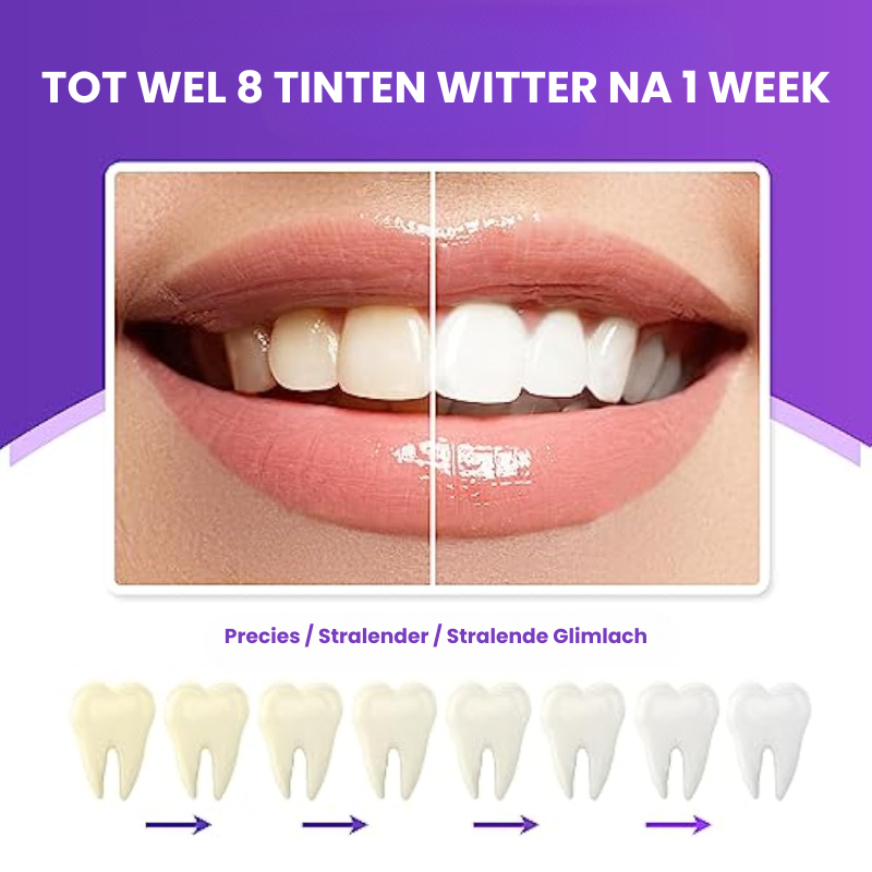 CLINISHEEN™ | Tandenbleekpen