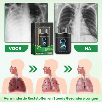 INHARELIVE™ | Kruidenlongdetox-inhalator