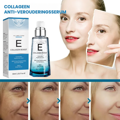 COLLBSERIQ™ | Anti-verouderingsserum