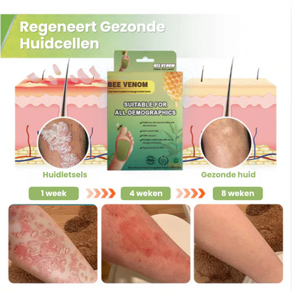 NociSlim™ | Ontgiftende Voetpleisters