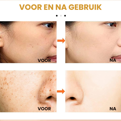 MELACIEL™ | Anti-pigmentatie Crème