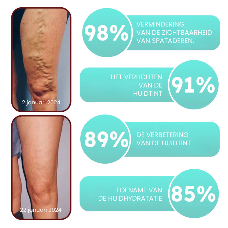 VascuMend™ | Spataderpleister