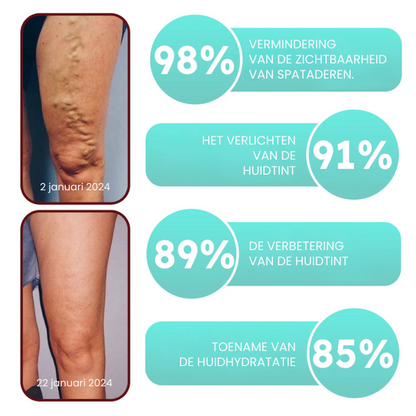 VascuMend™ | Spataderpleister