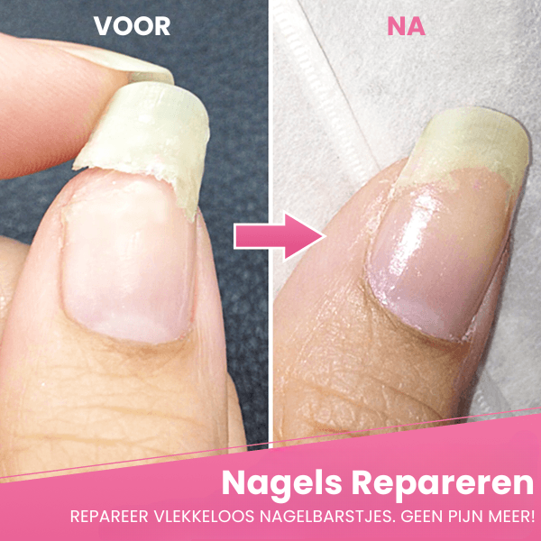 REIXA™ | Gebarsten Nagel Reparatie Gel