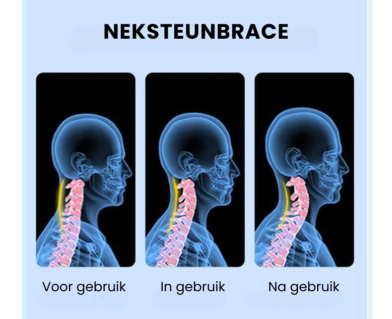 CerviSupport™ | Nek Brace