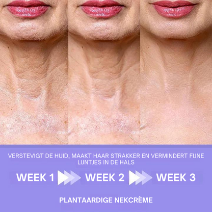 FirmSmooth™ | Plantaardige Nekcrème