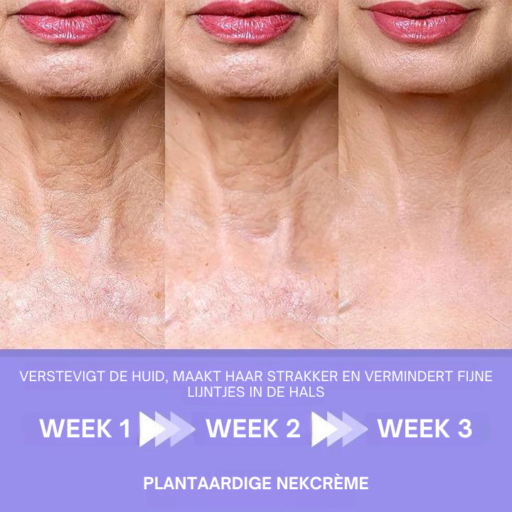 FirmSmooth™ | Plantaardige Nekcrème