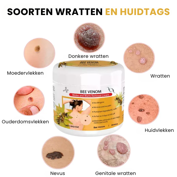 SpotGone™ | Moedervlek- en Wrattenbehandeling Crème