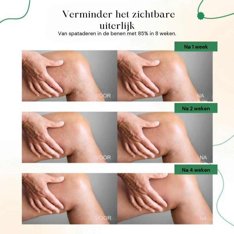 VeinRevive™ | Spataderen Herstel Crème