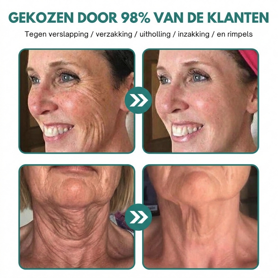 1+1 GRATIS: AntiAge™ | Rimpelcorrectie Crème