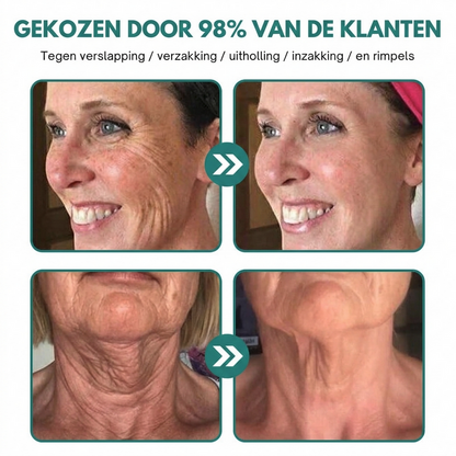 1+1 GRATIS: AntiAge™ | Rimpelcorrectie Crème