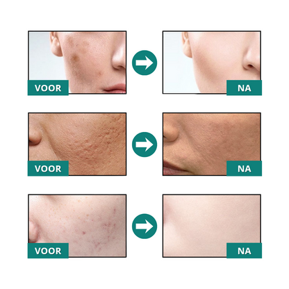 1+1 GRATIS: GlowSkin™ | Huid Egalisatie Serum