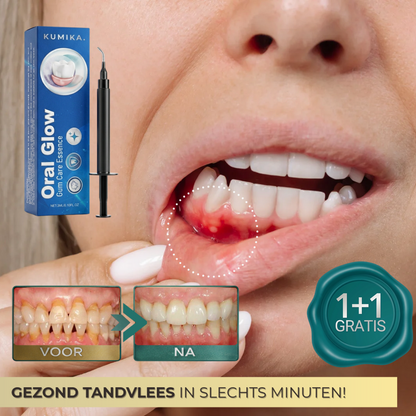 1+1 GRATIS: OralGlow™ | Tandvleesverzorgende Essentie Gel