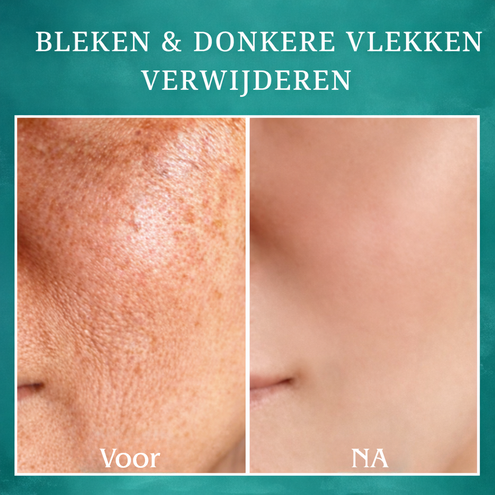 1+1 GRATIS: FirmLux™ | Verstevigende Crème