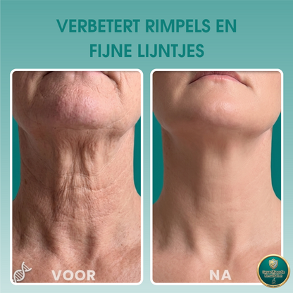 1+1 GRATIS: FirmLux™ | Verstevigende Crème
